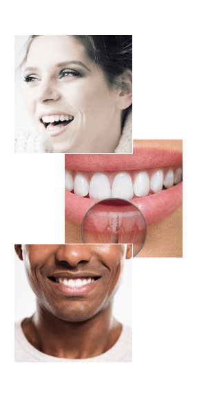 Implantes dentarios | Tratamento Clinica Dente de Leite