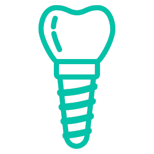 Implantes Dentários